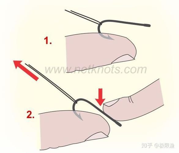 钓鱼钩扎进肉里怎么办